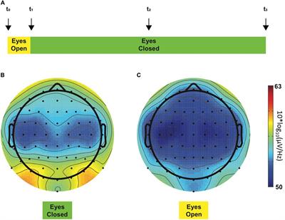 Beta Electroencephalographic Oscillation Is a Potential GABAergic Biomarker of Chronic Peripheral Neuropathic Pain